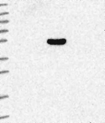 Western Blot: ARRDC4 Antibody [NBP3-17343]