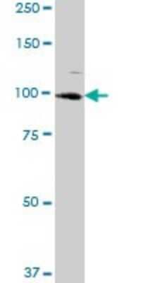 Western Blot: ARS2 Antibody [H00051593-B02P]