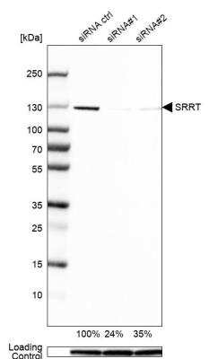 Western Blot: ARS2 Antibody [NBP2-13382]