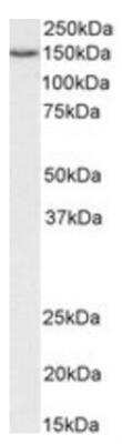 Western Blot: ARS2 Antibody [NBP2-42501]