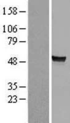 Western Blot: Arylsulfatase A/ARSA Overexpression Lysate [NBL1-07736]