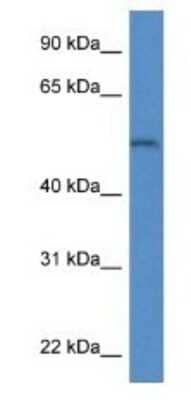 Western Blot: Arylsulfatase B/ARSB Antibody [NBP1-79727]