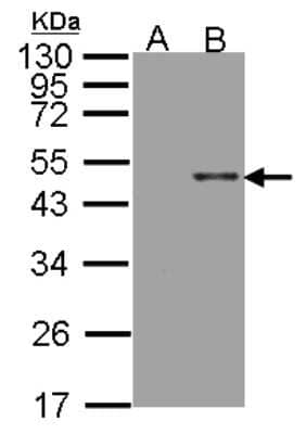 Western Blot: Arylsulfatase B/ARSB Antibody [NBP2-15474]