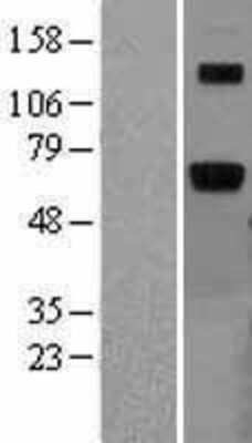 Western Blot: Arylsulfatase B/ARSB Overexpression Lysate [NBL1-07737]