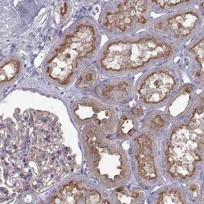 Immunohistochemistry: ARSE Antibody [NBP2-68904]