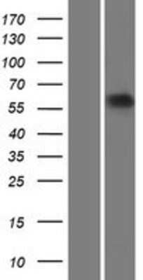 Western Blot: ARSE Overexpression Lysate [NBP2-09060]