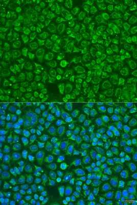 Immunocytochemistry/ Immunofluorescence: ARSF Antibody - BSA Free [NBP3-04502]