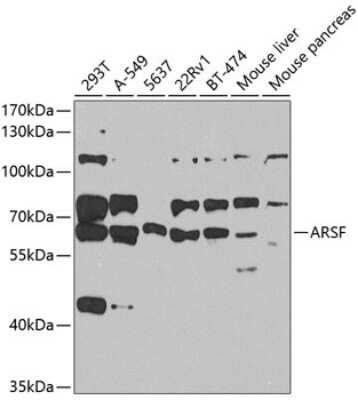 Western Blot: ARSF AntibodyBSA Free [NBP2-92826]