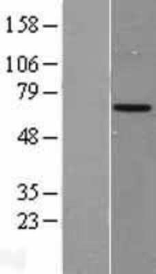 Western Blot: ARSF Overexpression Lysate [NBL1-07740]