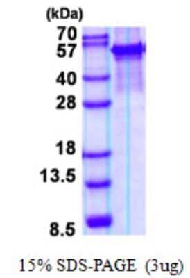 SDS-PAGE: Recombinant Human Arylsulfatase G/ARSG His Protein [NBP2-22696]