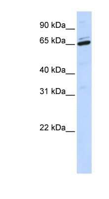 Western Blot: ARSH Antibody [NBP1-59370]