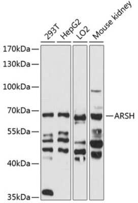 Western Blot: ARSH AntibodyBSA Free [NBP2-92083]