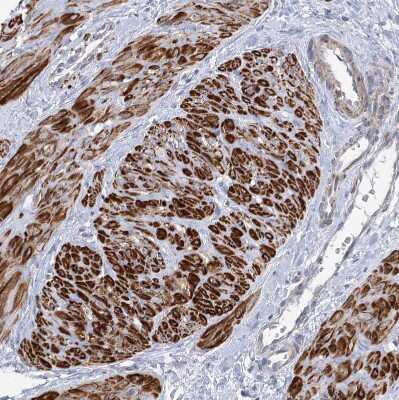 Immunohistochemistry-Paraffin: ARSI Antibody [NBP2-48681]