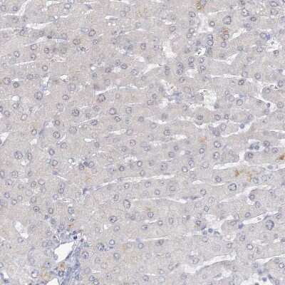 Immunohistochemistry-Paraffin: ARSI Antibody [NBP2-48681]