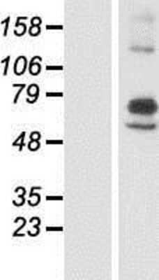 Western Blot: ARSI Overexpression Lysate [NBP2-08790]