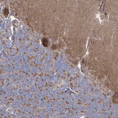 Immunohistochemistry: ARSJ Antibody [NBP2-48658]