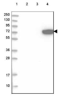 Western Blot: ARSJ Antibody [NBP2-48658]