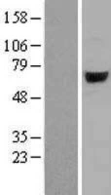 Western Blot: ARSJ Overexpression Lysate [NBL1-07742]