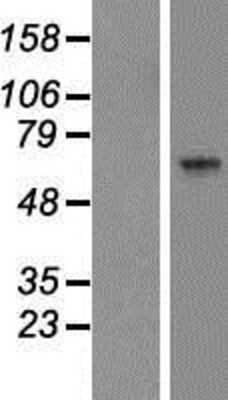 Western Blot: ARSK Overexpression Lysate [NBP2-04737]