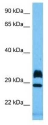 Western Blot: ART-2A Antibody [NBP3-10187]