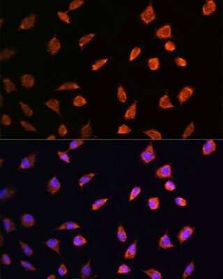Immunocytochemistry/ Immunofluorescence: ART1 Antibody - BSA Free [NBP2-91995]