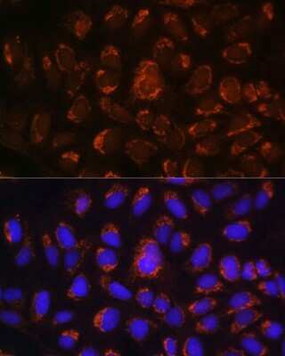 Immunocytochemistry/ Immunofluorescence: ART1 Antibody - BSA Free [NBP2-91995]