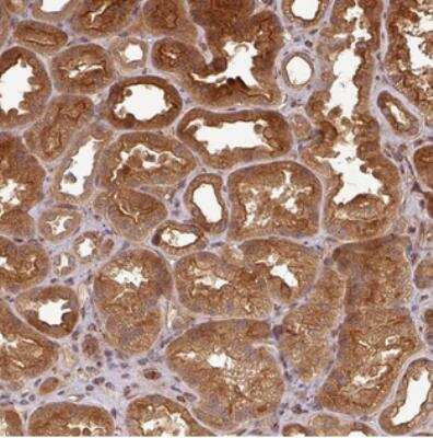 Immunohistochemistry: ART1 Antibody [NBP2-30904]