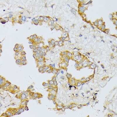 Immunohistochemistry-Paraffin: ART1 Antibody - BSA Free [NBP2-91995]