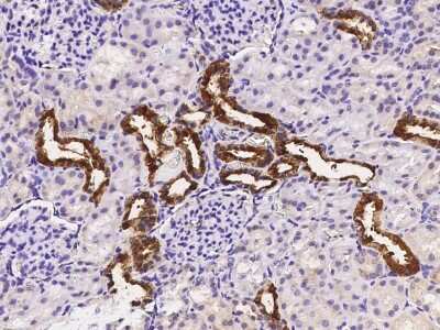 Immunohistochemistry-Paraffin: ART1 Antibody [NBP2-98460]