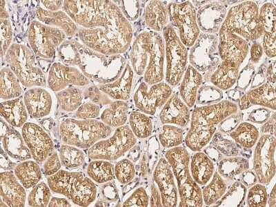 Immunohistochemistry-Paraffin: ART1 Antibody [NBP2-99051]