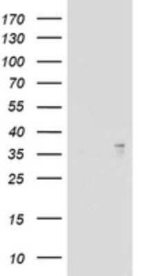 Western Blot: ART1 Antibody (OTI6E2)Azide and BSA Free [NBP2-70211]