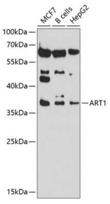 Western Blot: ART1 AntibodyBSA Free [NBP2-91995]