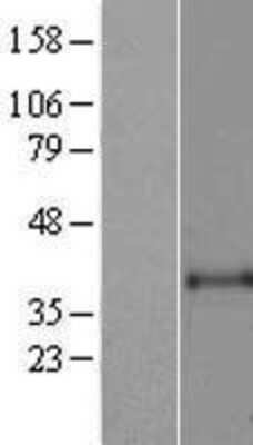 Western Blot: ART1 Overexpression Lysate [NBP2-07882]