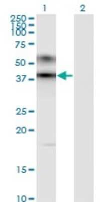 Western Blot: ART3 Antibody (1D2) [H00000419-M09]