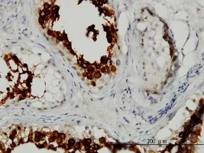 Immunohistochemistry-Paraffin: ART3 Antibody (3A2) [H00000419-M05]