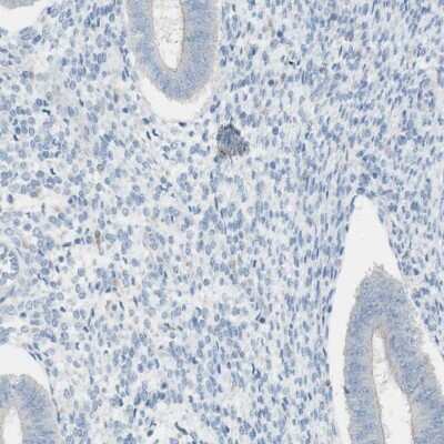 Immunohistochemistry-Paraffin: ART3 Antibody [NBP1-86479]