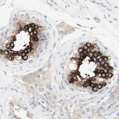 Immunohistochemistry-Paraffin: ART3 Antibody [NBP1-86479]