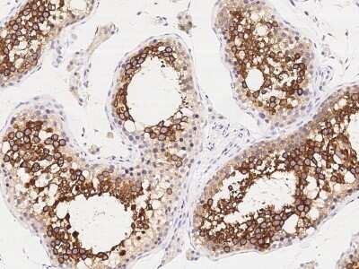 Immunohistochemistry-Paraffin: ART3 Antibody [NBP3-00144]