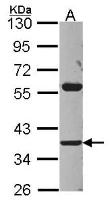 Western Blot: ART3 Antibody [NBP2-15475]