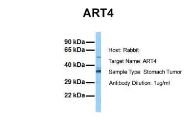 Western Blot: ART4 Antibody [NBP1-80507]