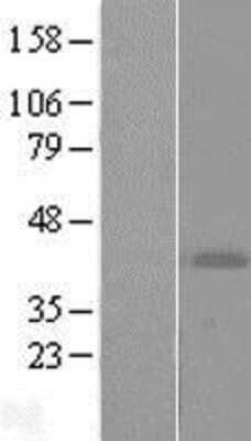 Western Blot: ART4 Overexpression Lysate [NBL1-07743]