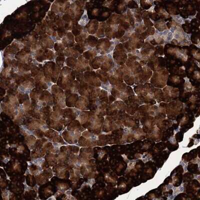 Immunohistochemistry: ART5 Antibody [NBP2-48744]