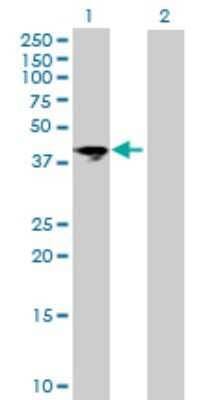 Western Blot: ART5 Antibody [H00116969-B01P]