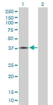 Western Blot: ART5 Antibody [H00116969-B02P]