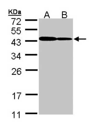 Western Blot: ART5 Antibody [NBP1-32664]