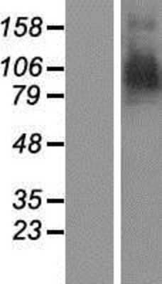 Western Blot: Aminopeptidase PILS/ARTS1 Overexpression Lysate [NBP2-10627]