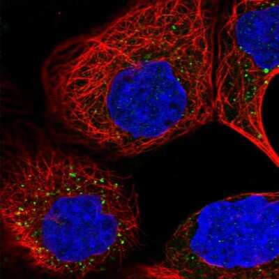 Immunocytochemistry/ Immunofluorescence: ARV1 Antibody [NBP2-48641]