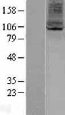 Western Blot: ARV1 Overexpression Lysate [NBP2-04390]