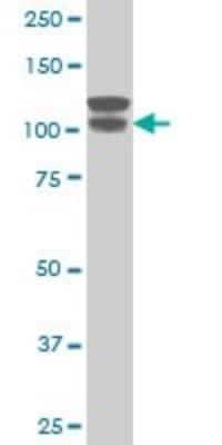 Western Blot: ARVCF Antibody (5D2) [H00000421-M01]