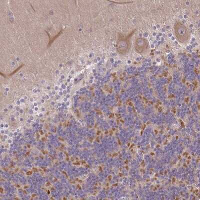 Immunohistochemistry-Paraffin: ARVCF Antibody [NBP2-38999]